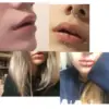 Сережка з титану для пірсингу губи U-подібна Lippy loop